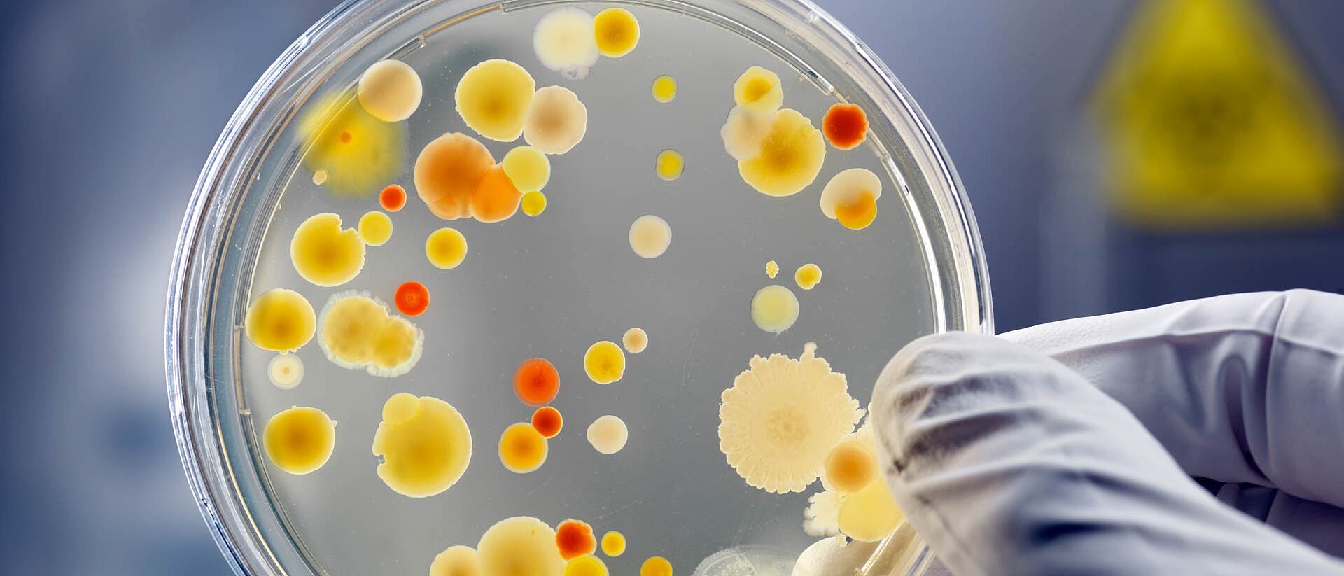 Mano con guante sosteniendo una placa de Petri con bacterias naranjas y amarillas